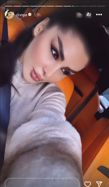 عکس دنیا جهانبخت قبل و بعد از عمل