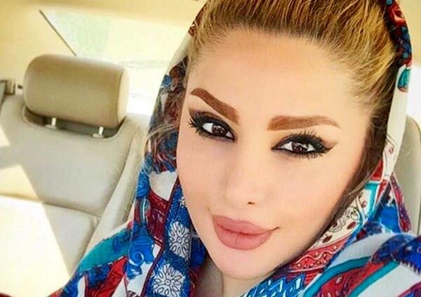عکس دنیا جهانبخت قبل و بعد از عمل