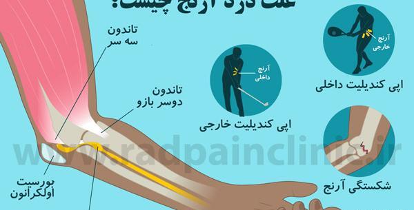 عکس تاتو آرنج دست