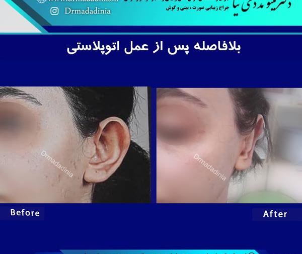 عکس حنجره اهواز