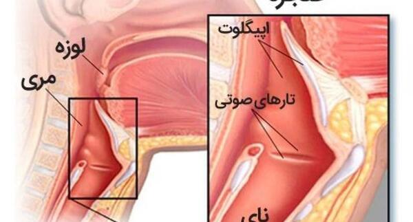 عکس حنجره اهواز
