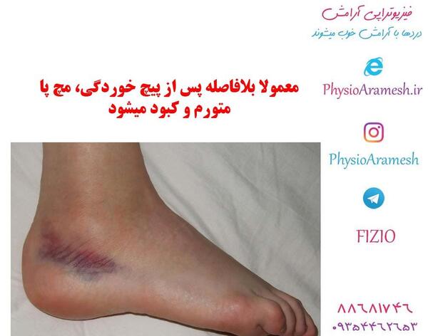 عکس شکم کبود شده