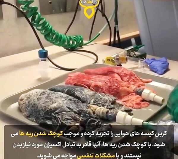 عکس ریه انسان