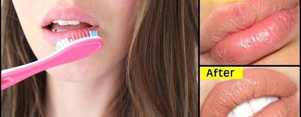 عکس لب های پروتز شده