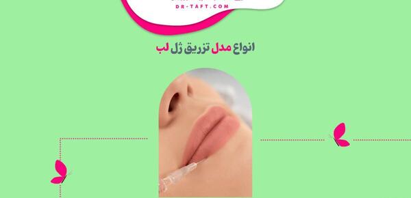 عکس لب های پروتز شده