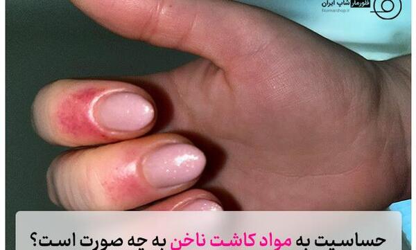 عکس کاور ناخن نی نی سایت