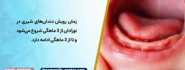 عکس لثه نوزاد هنگام دندان دراوردن