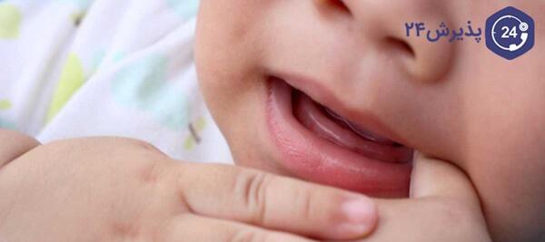 عکس لثه نوزاد هنگام دندان دراوردن