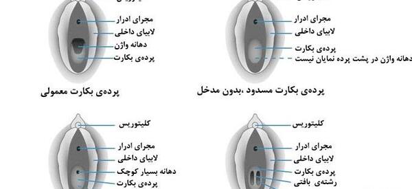 سقط عکس لکه بینی در بارداری