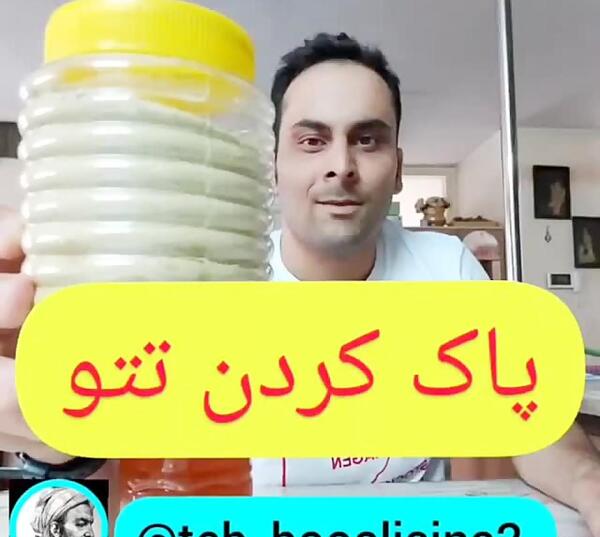 عکس دستگاه لیزر تاتو