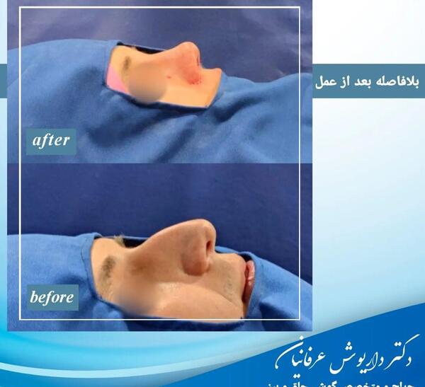 عکس های فانتزی جهنم
