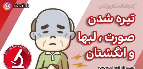 عکس ریه با درگیری کم