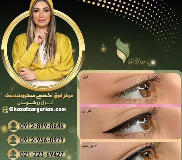 عکس چشم تام