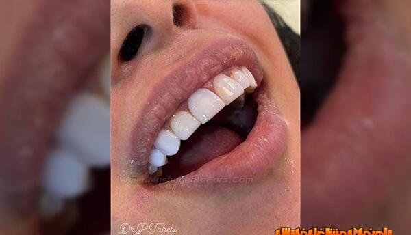 عکس پویا طاهری