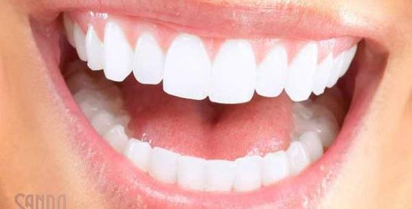 عکس سفید شدن لثه
