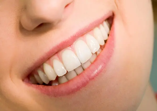 عکس سفید شدن لثه