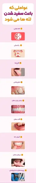 عکس سفید شدن لثه