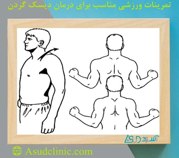 عکس ورزش دیسک گردن