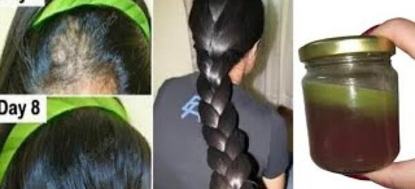 شپش عکس زخم پوست سر