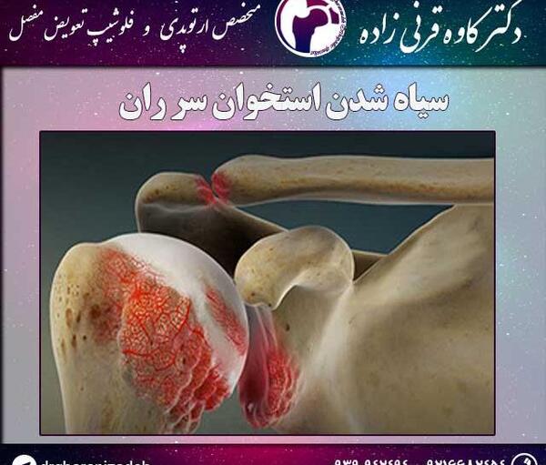 عکس کبودی لگن
