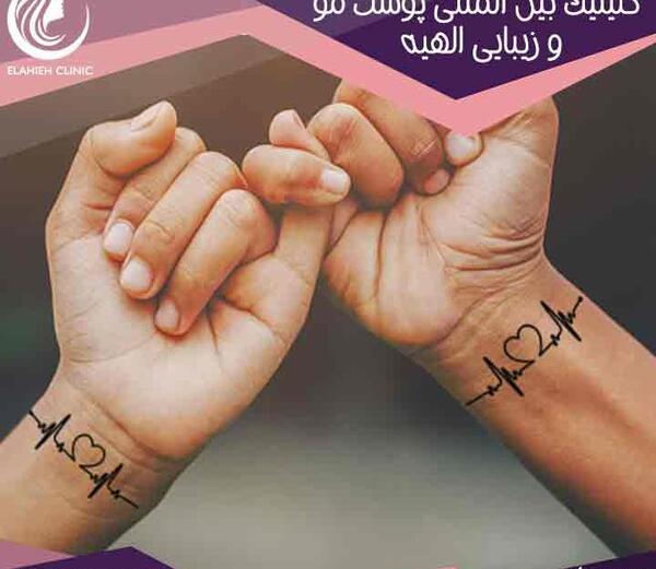 عکس تاتو دست سرلک