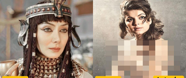 عکس قبل جراحی زلیخا