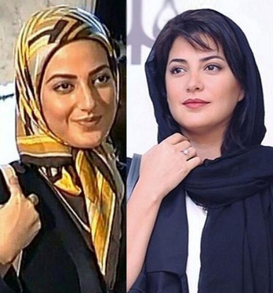 عکس قبل جراحی زلیخا