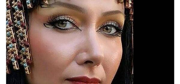 عکس قبل جراحی زلیخا