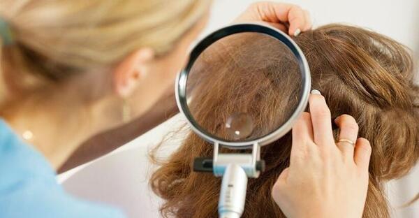 عکس شپش ریز
