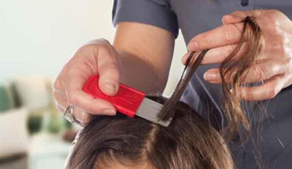 عکس شپش ریز