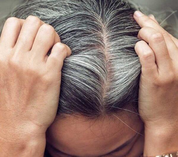 عکس سفید شدن مو