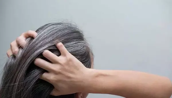 عکس سفید شدن مو