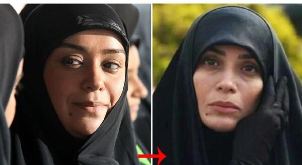 عکس قبل و بعد الهام چرخنده