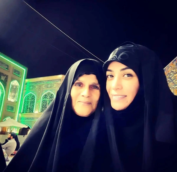 عکس قبل و بعد الهام چرخنده