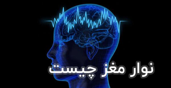عکس ام ار ای مغز ناسالم
