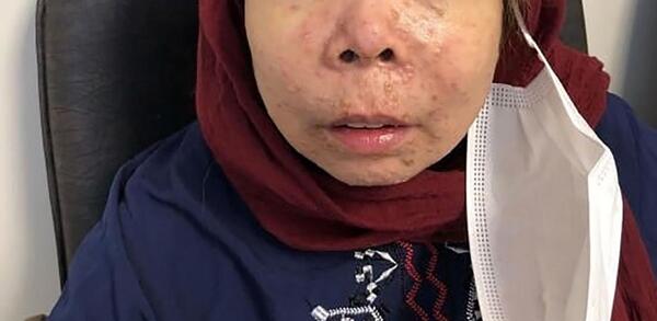 عکس ابله میمونی