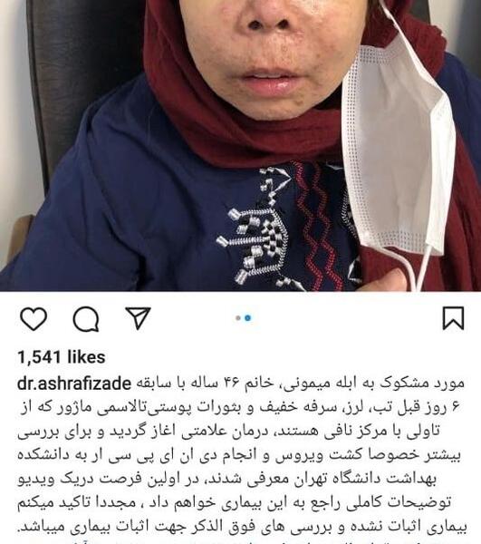 عکس ابله میمونی