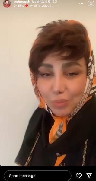 عکس بهنوش بختیاری بدون آرایش
