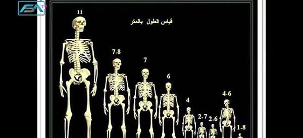 عکس اسکلت انسان واقعی