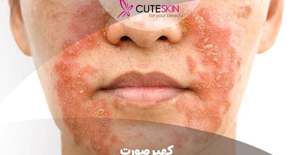 عکس آهو روی صورت