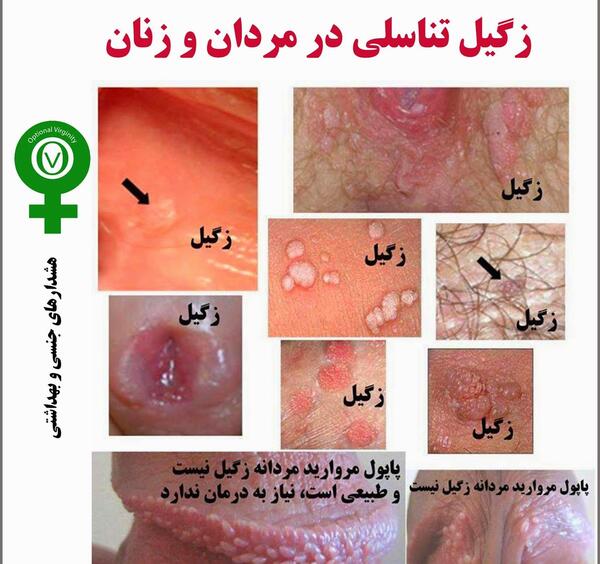 عکس آهو روی صورت