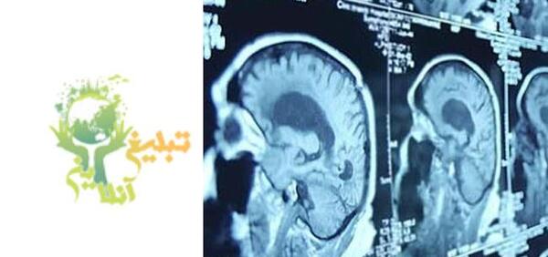 عکس مینو آذر