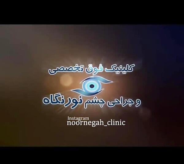 عکس چشم لیزیک