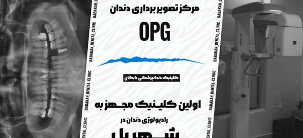 عکس دندان قبل از بارداری
