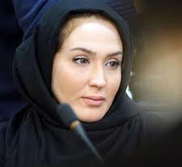 عکس زهره فکور صبور قبل از عمل بینی