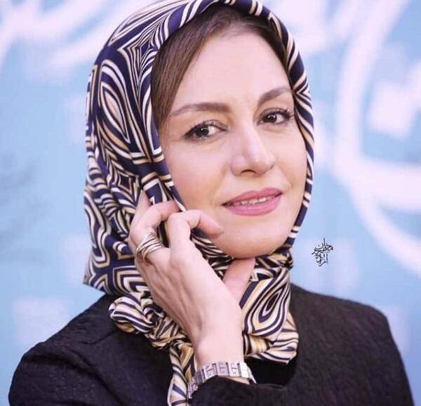 عکس باران کوثری قبل از عمل