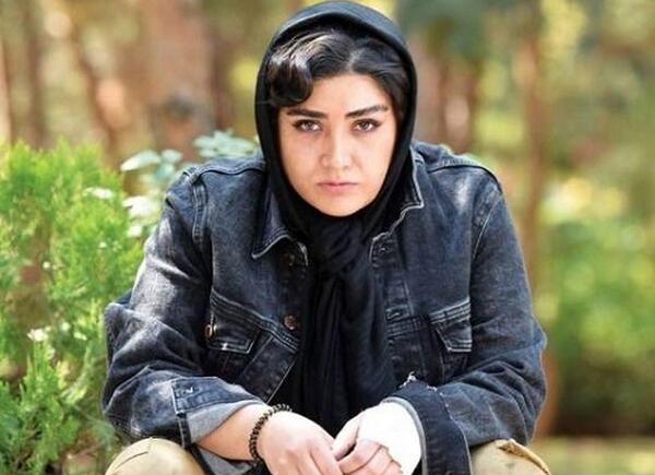 عکس باران کوثری قبل از عمل