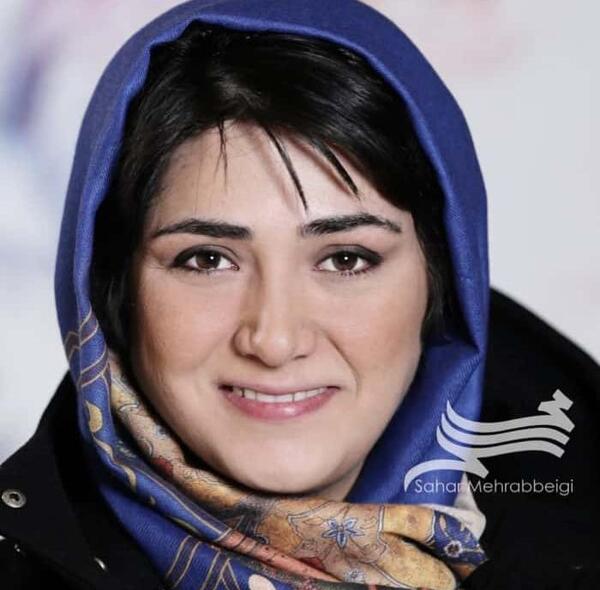 عکس باران کوثری قبل از عمل