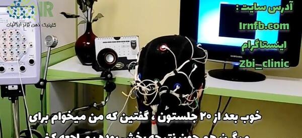 عکس شپش سر زنده