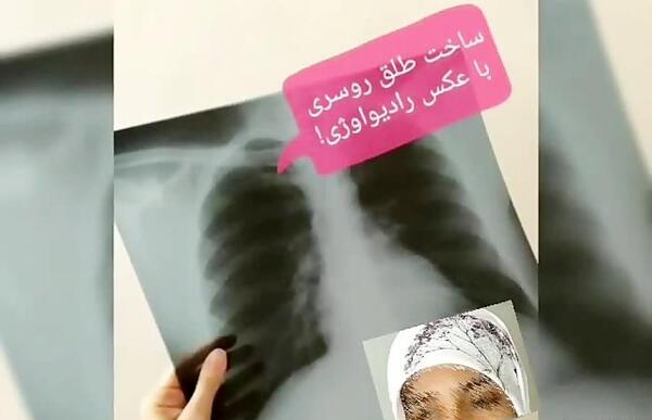 عکس طلق مقنعه